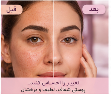 ماسک صورت خاک رس آلا تار (Alatar Mud Mask) | پاکسازی، روشنکننده و شادابکننده پوست